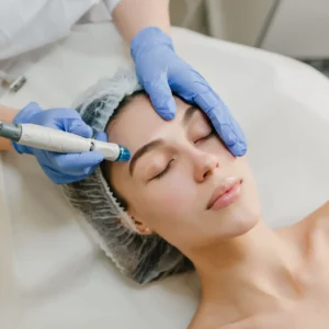 Tratamiento de limpieza profunda con hidrodermoabrasión en rostro